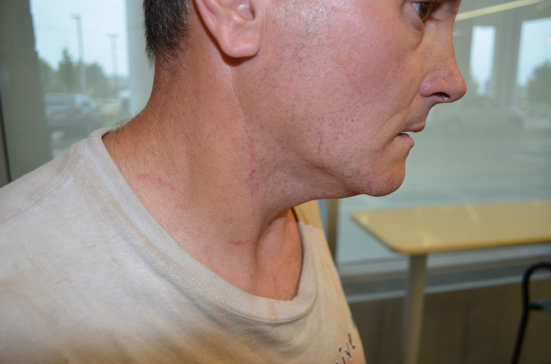 Todd Kendhammer's neck
